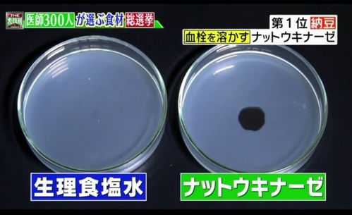 日本爆发 纳豆危机 国民抢光纳豆产品防疫